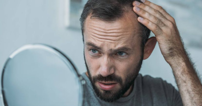 Capecitabina e Queda de Cabelo: Como Esse Efeito Colateral Pode Acontecer